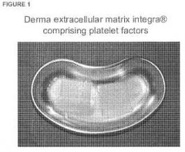 EXTRACELLULAR MATRIX COMPRISING PLATELET FACTORS