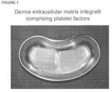 EXTRACELLULAR MATRIX COMPRISING PLATELET FACTORS